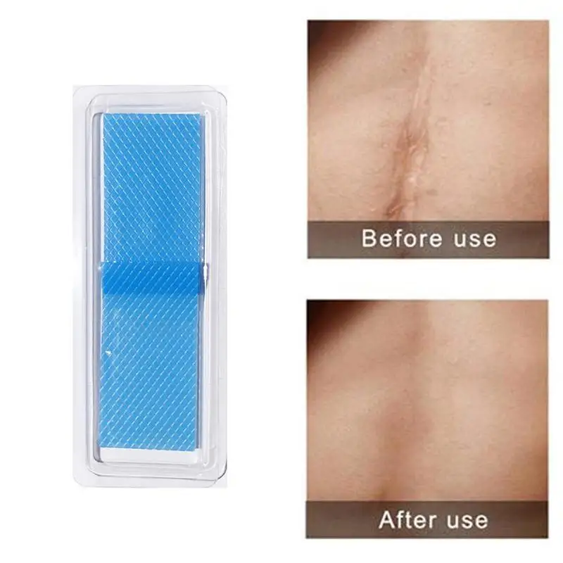 Многоразовый гель от угрей пластырь для удаления шрамов терапия быстрое