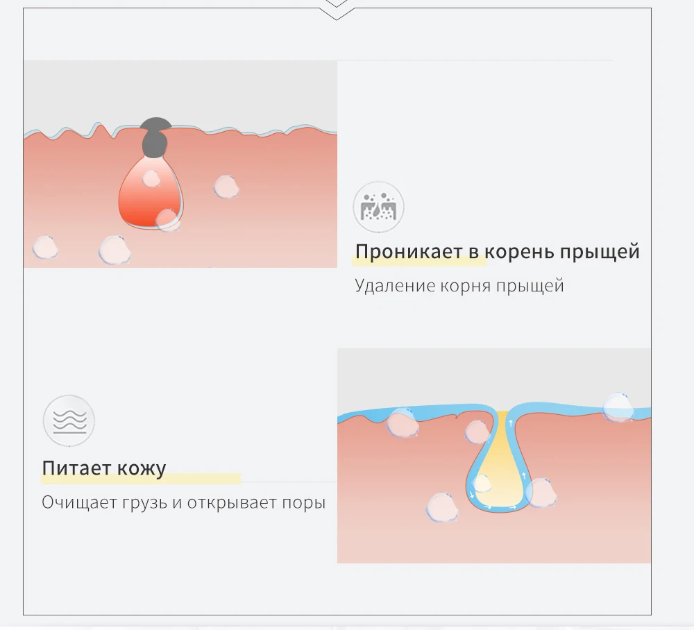 HANAJIRUSHI, лечение акне, Удаление прыщей, гель для лечения, чистый и прозрачный гель от угрей, контроль глубокого масла, против акне, увлажнение кожи, 25 г
