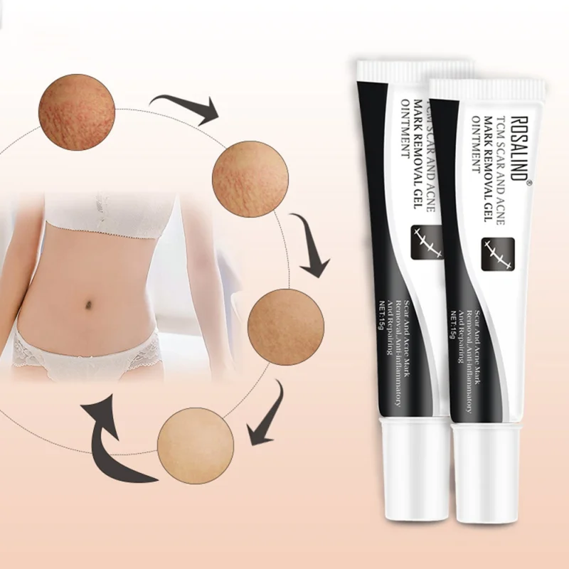 Acne Scar Removal Cream Skin Repair Face Spots Treatment Blackhead Whitening Stretch Marks | Красота и здоровье