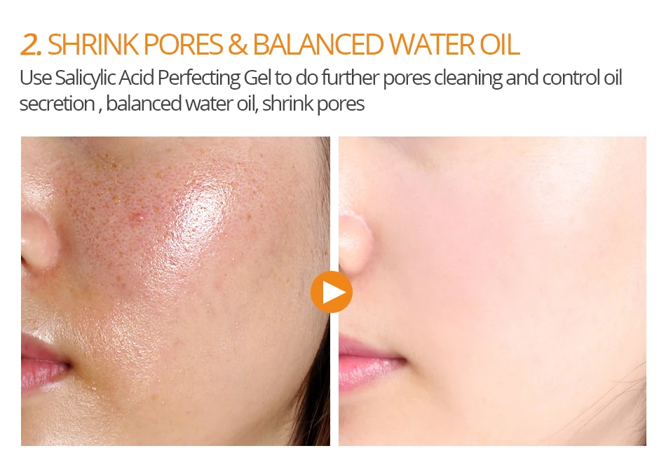 VIBRANT GLAMOUR Salicylic Acid Condensation Cream удалить маска для лица против прыщей масло управление уход за кожей лечение пигментации корректор 100 г
