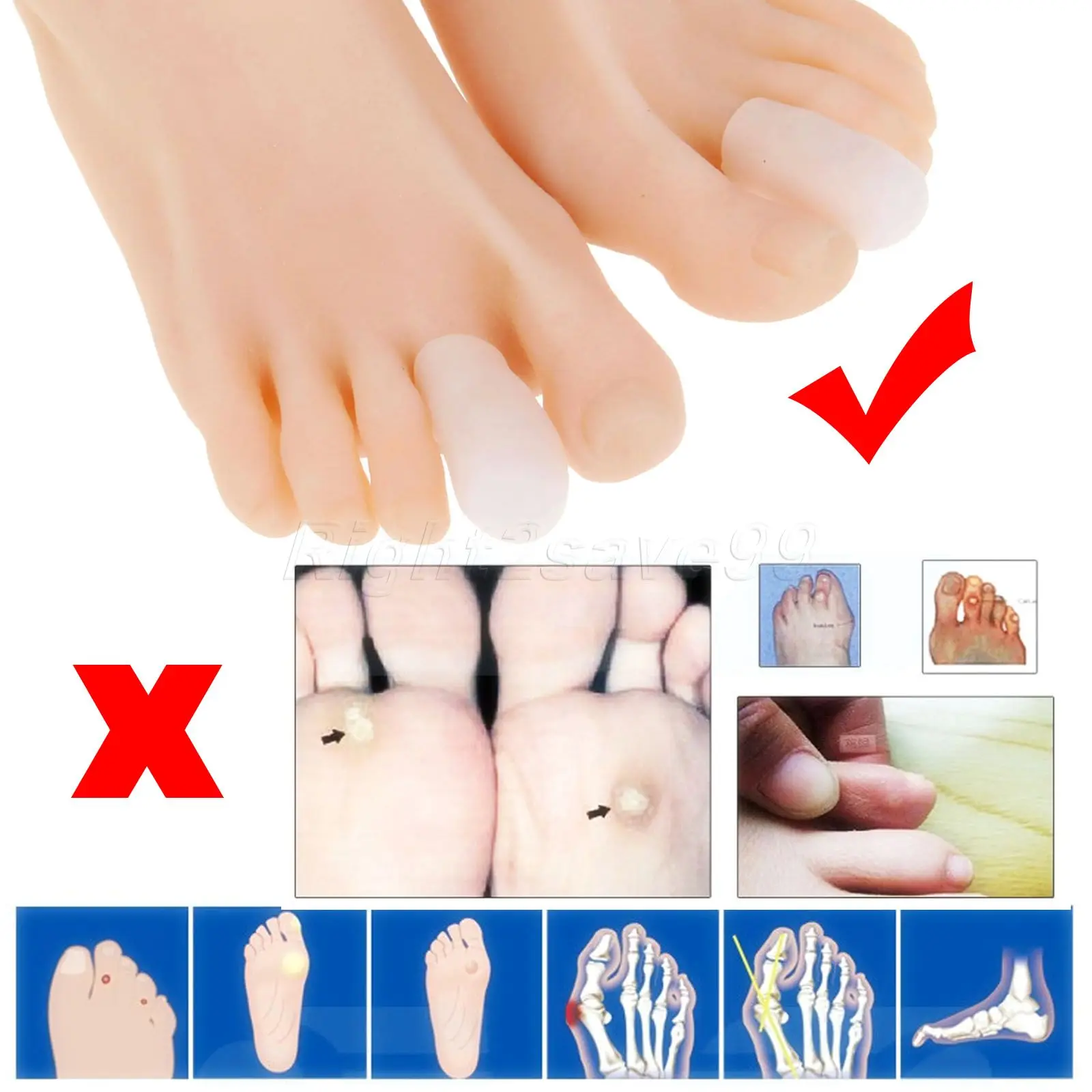 Защитные колпачки для пальцев ног 1 пара силиконовые гелевые пузырьки молота