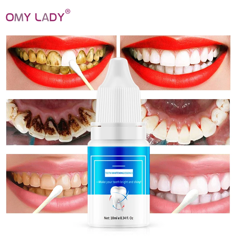 OMY LADY отбеливающая эссенция для зубов гигиена полости рта очищающая сыворотка