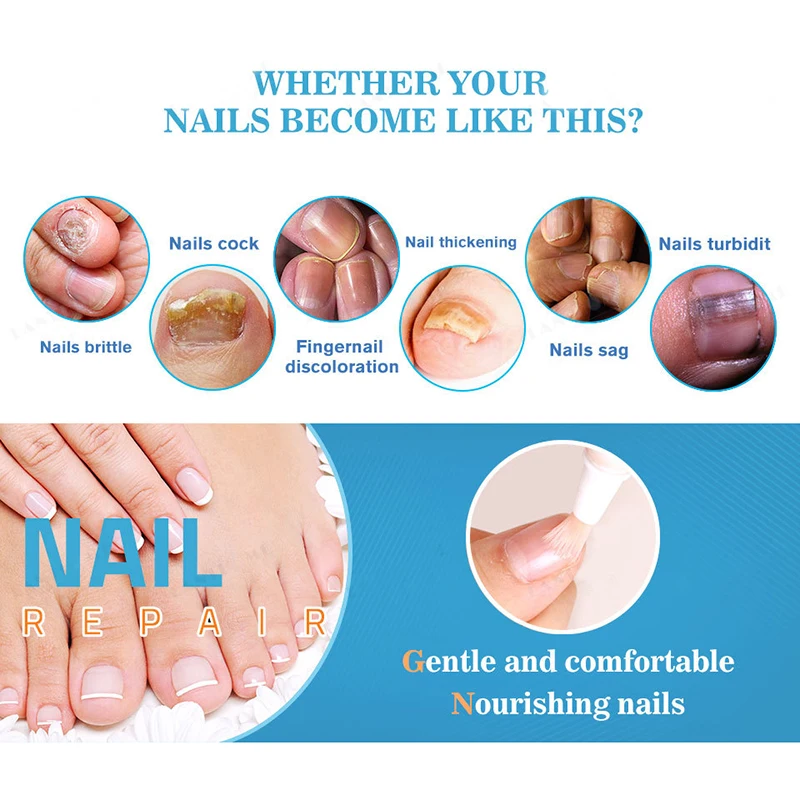 1 шт. жидкость для ремонта ногтей против грибок Питательный Уход за ногами FM88| |