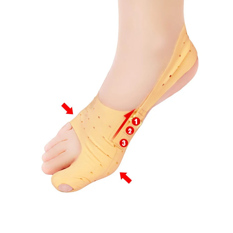 1 шт. ортопедические скобы для коррекции вальгусной деформации большого пальца |