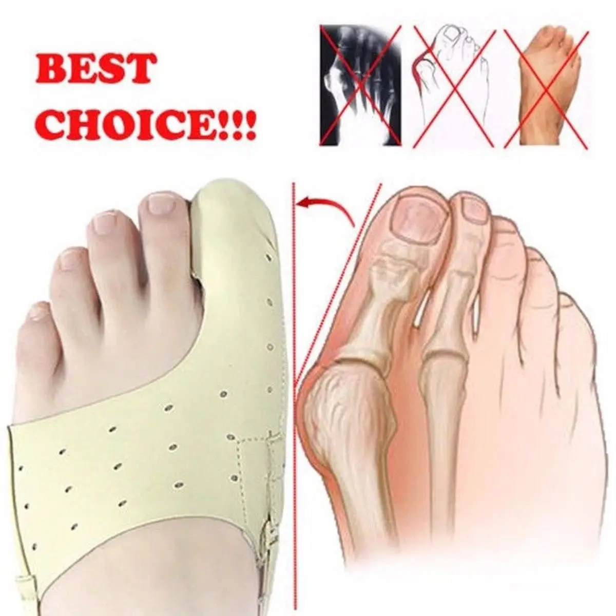 Эластичный корректор Bunion 1 шт. инструмент для ухода за ногами разделитель