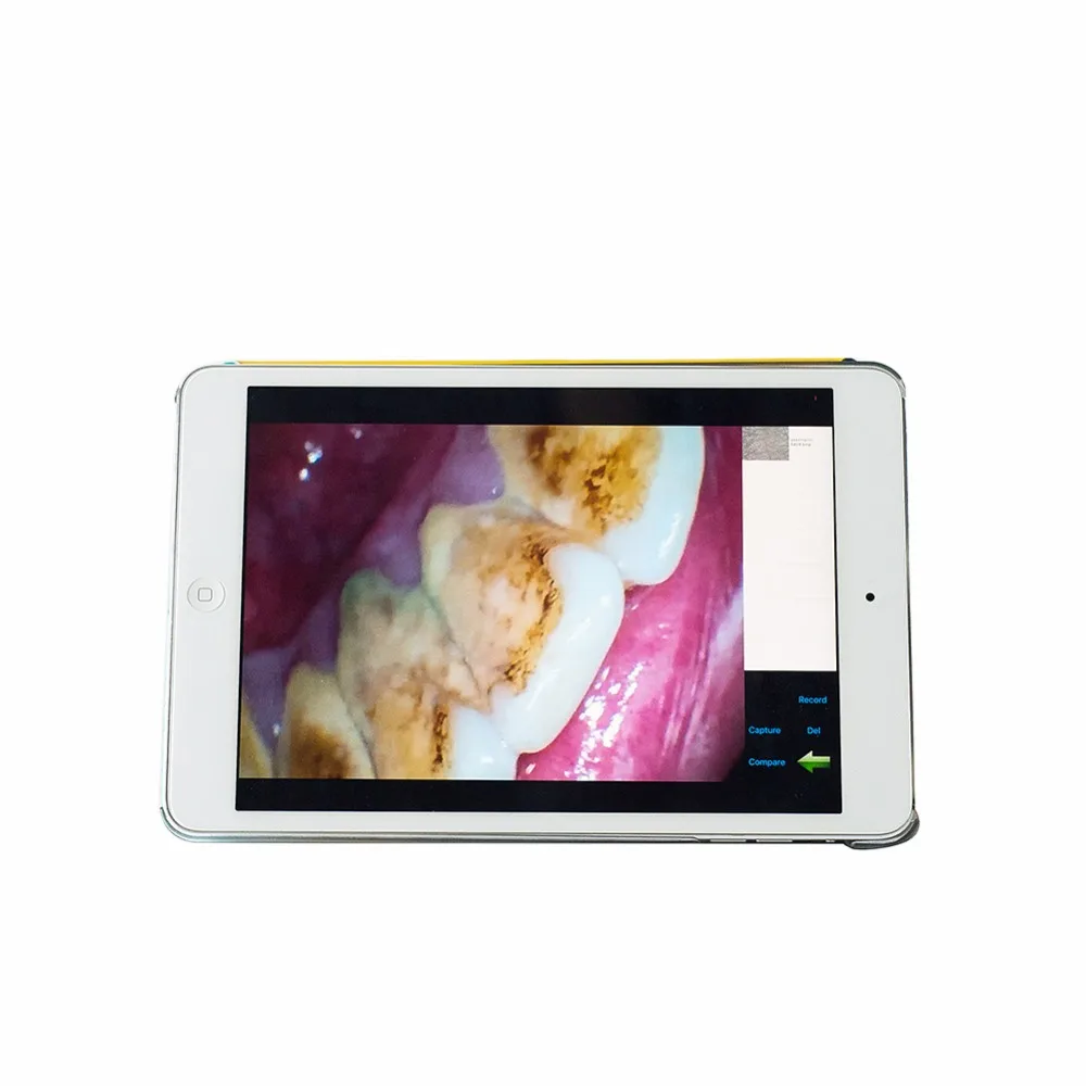 EASYINSMILE стоматологическая интраоральная камера беспроводная HD с высоким