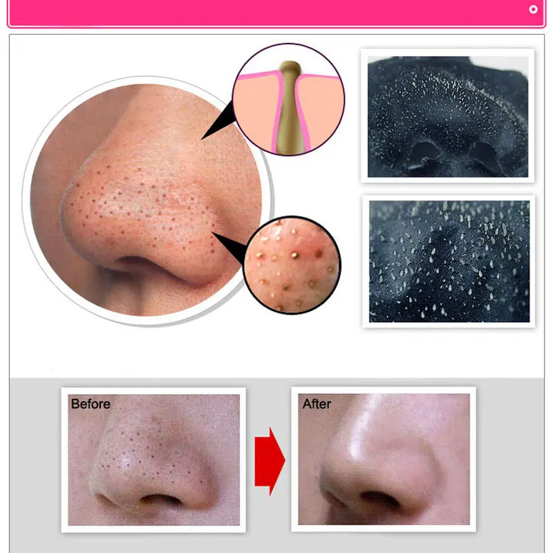 Прямая поставка средство для ухода за лицом маска удаления черных точек глубокое