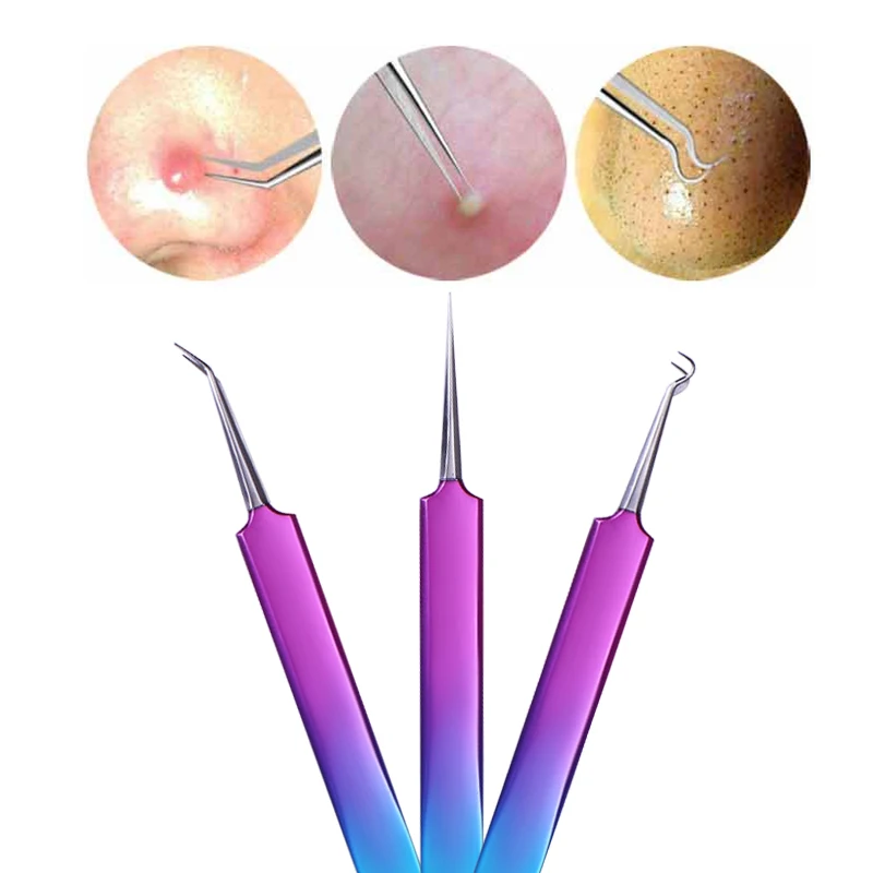 1 шт. Пинцет Для Удаления угревой сыпи Изогнутый пинцет для ухода за лицом