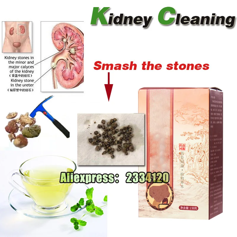 Kidney stone treatment Kidney Cleaning cleaning kidney stone product