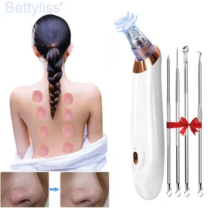 Вакуумный прибор для удаления угрей, средство для очищения пор и носа