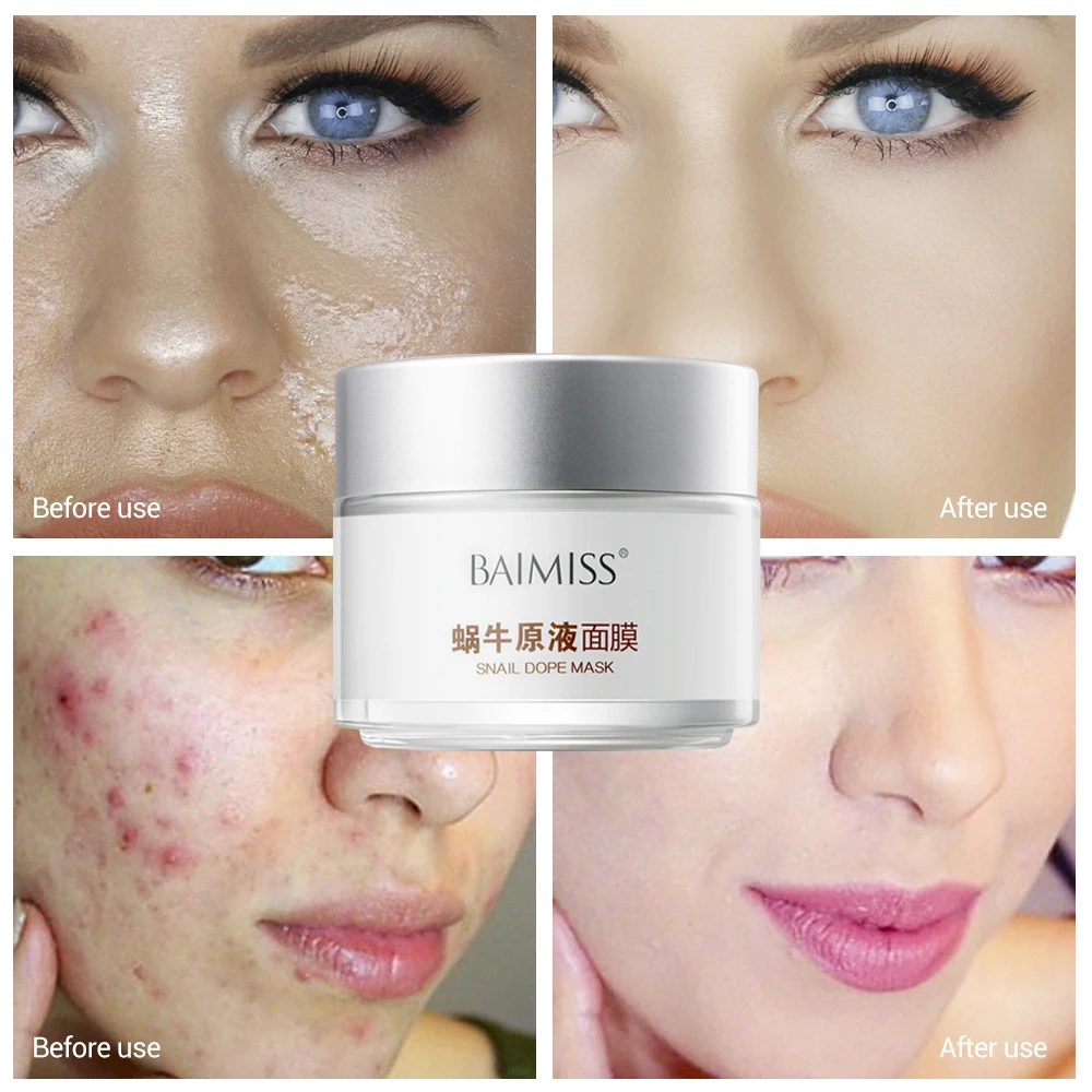 Baimiss улитка сыворотка маска ремонт лечение акне черная голова удаления уход за