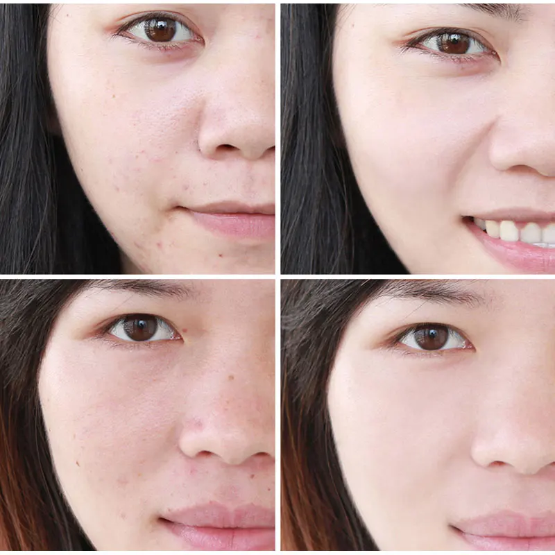 

Acymer Skin Repair Serum 100ml Moisturizing Soothes Skin Gentle Recovering Face Essence AC05