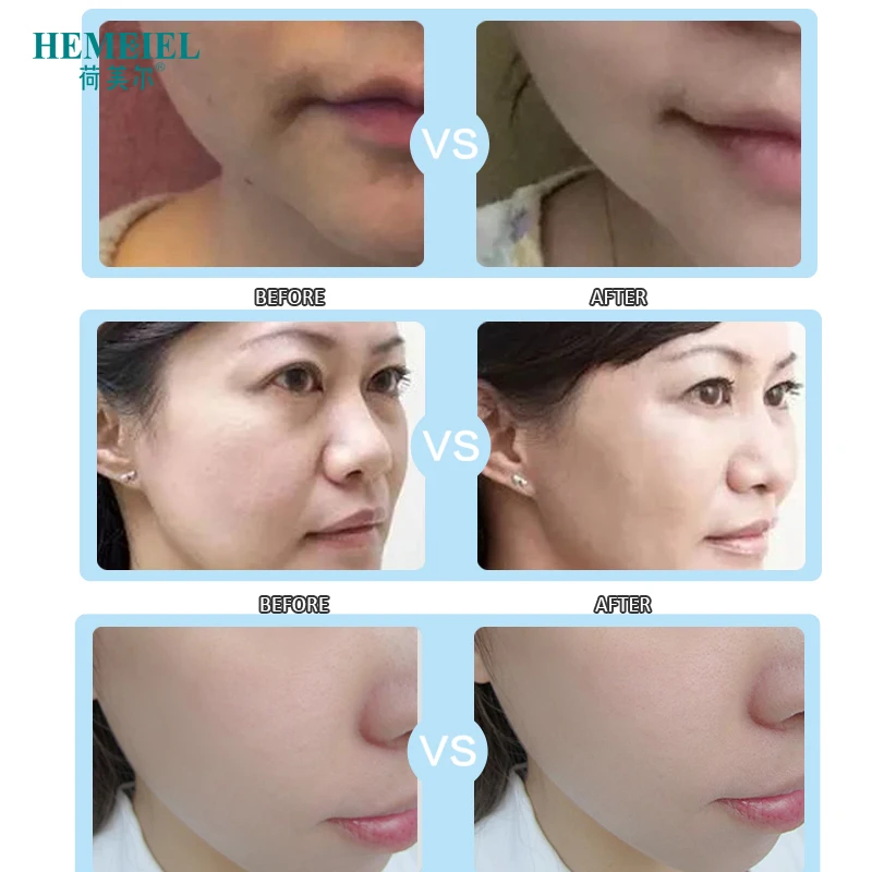 

HEMEIEL Caviar Essence Firming Mask for Face Anti-Aging Wrinkle Remove Facial Mask Whitening Moisturizing Treatment Mask Korean