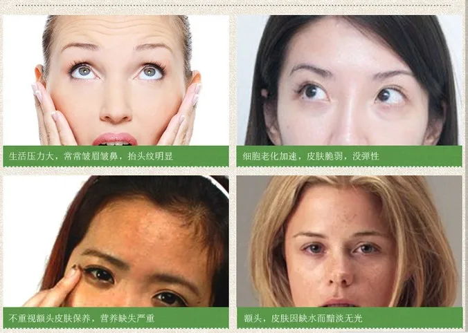 10 шт. натуральные ингредиенты против морщин маска на лоб для сна частная этикетка