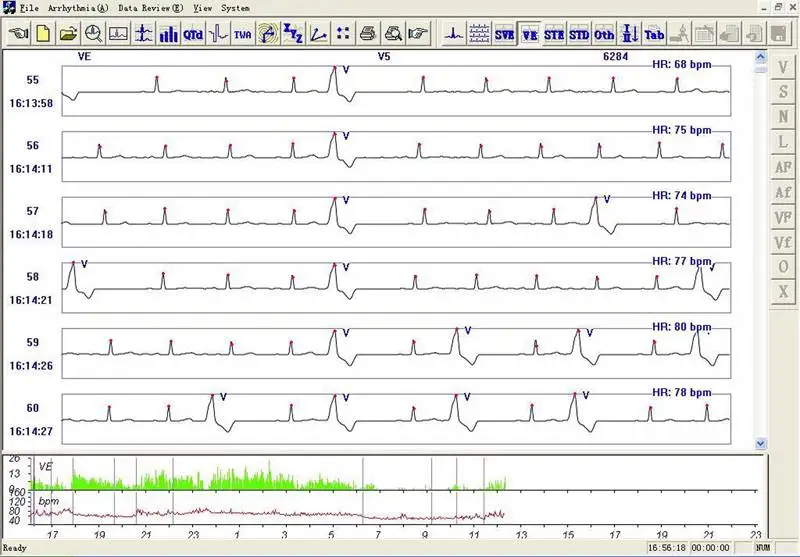 Динамические системы ЭКГ TLC6000 динамические 12 свинцовых систем Holter 48 часов записи