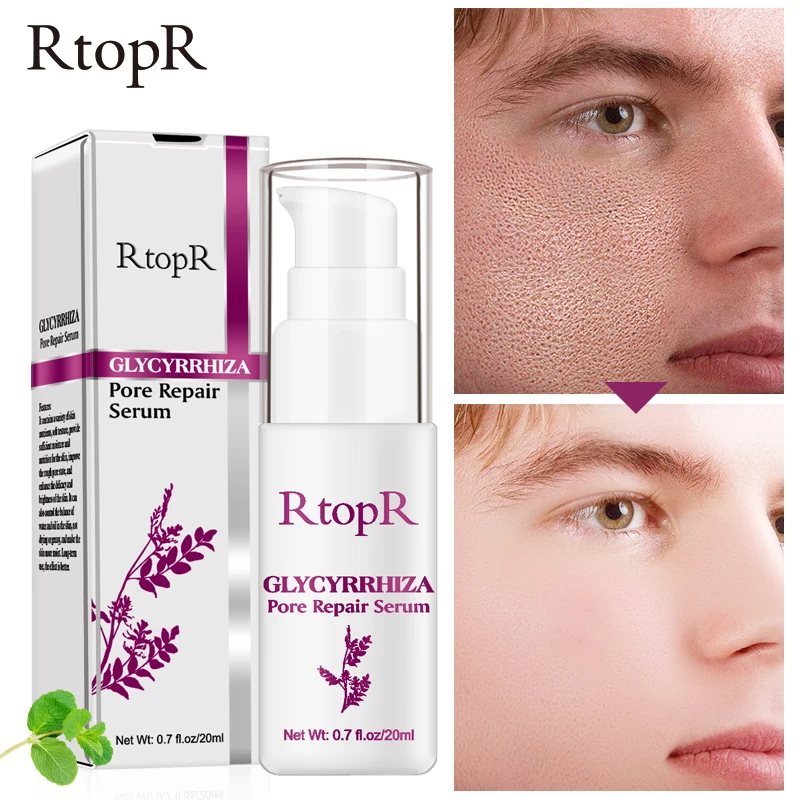 RtopR Glycyrrhiza восстанавливающая поры сыворотка коллаген отбеливающий крем для лица контроль над маслом увлажняющий эффективный Сужающий поры эссенция