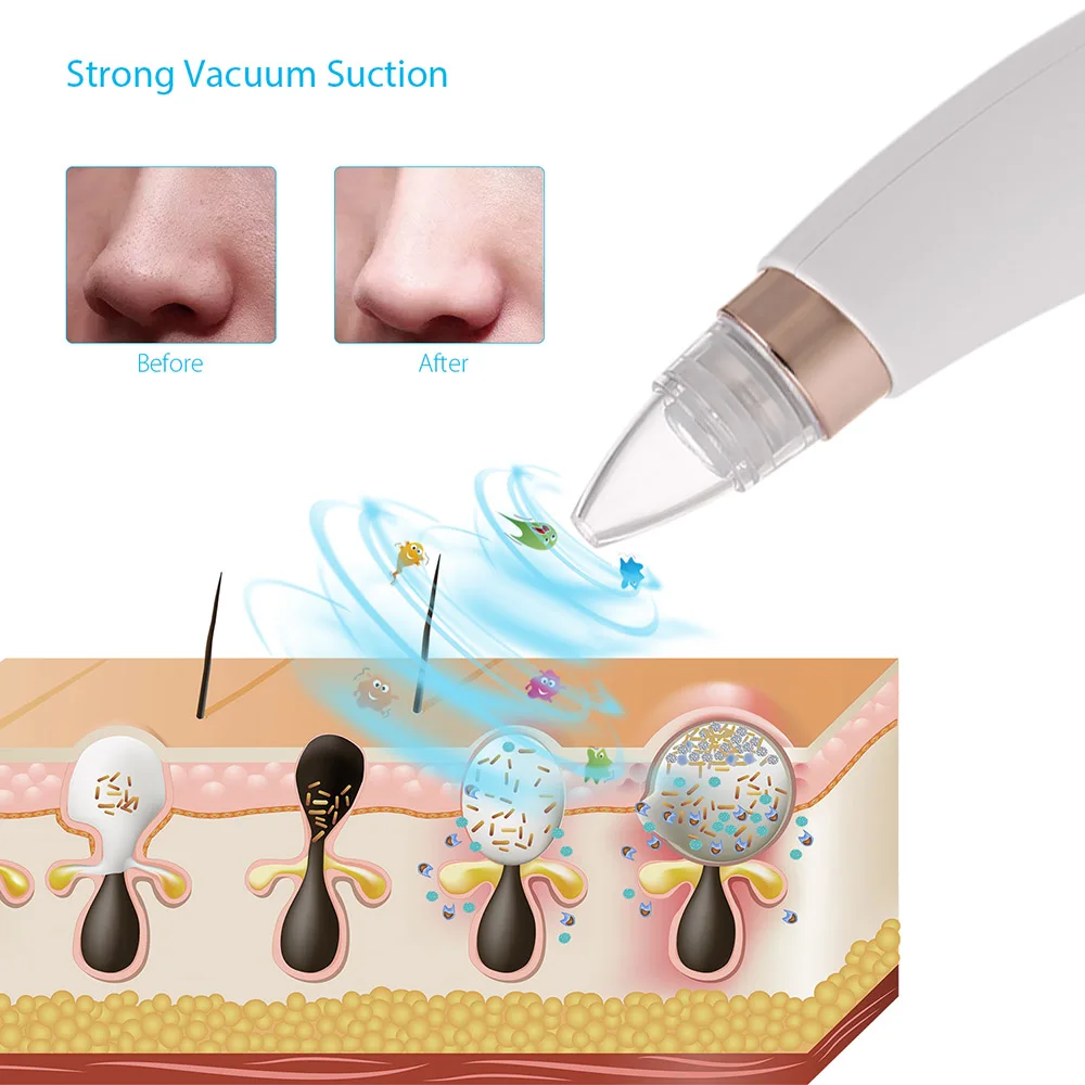 Blackhead Remover Vacuum Facial Pore Dot Blackhead Cleaner Electronic LED Display Extraction Kit Black Dot Head Remover Tools