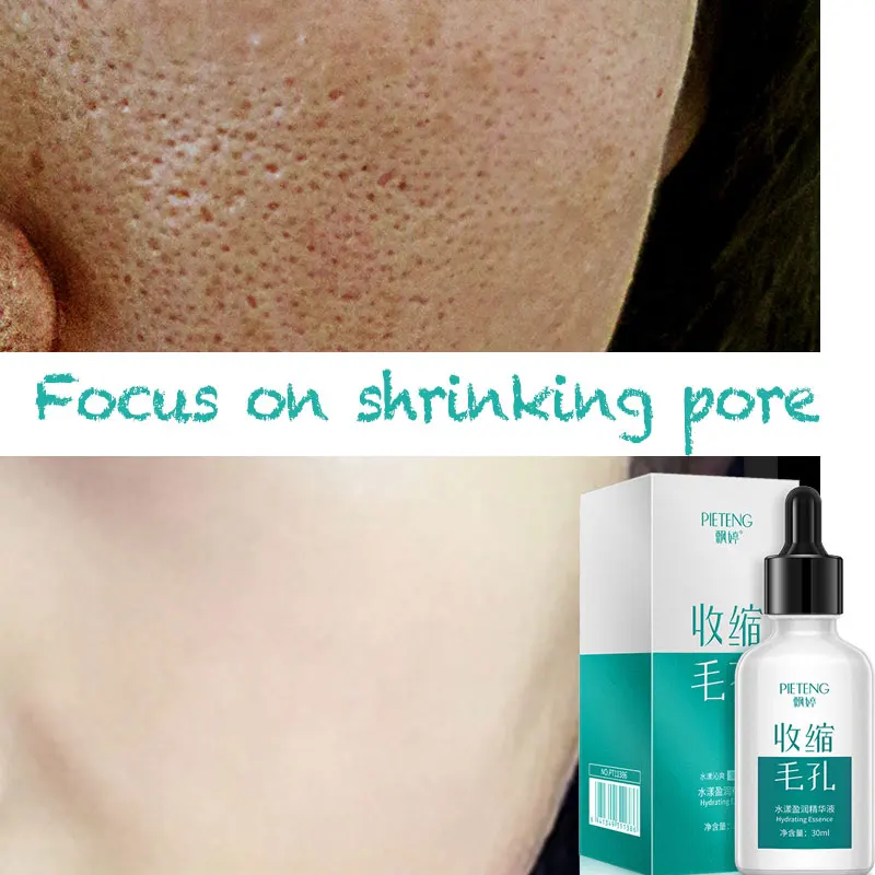 Маска для уменьшения пор Сыворотка для лица retinol suero visage увлажняющая усадка эссенция пор уход за кожей