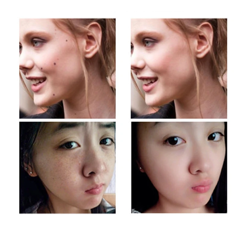 Электрическая машинка карандаш для удаления татуировок с жидкокристаллическим