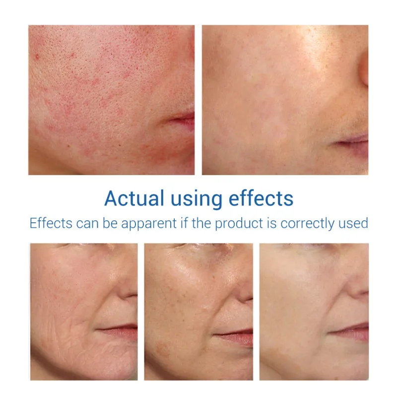 

40ml Nourishing Hyaluronic Acid Face Serum Pores Tighten Replenish Smooth Fine Lines Moisturize Face Skin Care