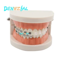 new orthodontics model for dentist dental 12 standard dentition with half metal brackets half ceramic bracket teeth model