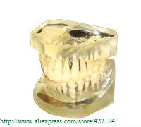 Бесплатная доставка модель необычной (10 шт. * 1 комплект) модели ортодонтических