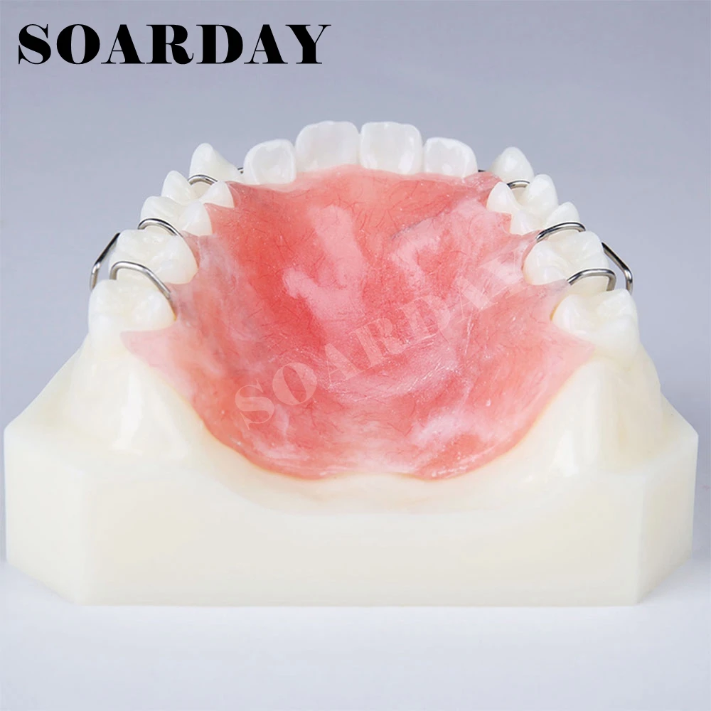 Зубной фиксатор демонстрационная модель ортодонтической терапии|orthodontic model|dental