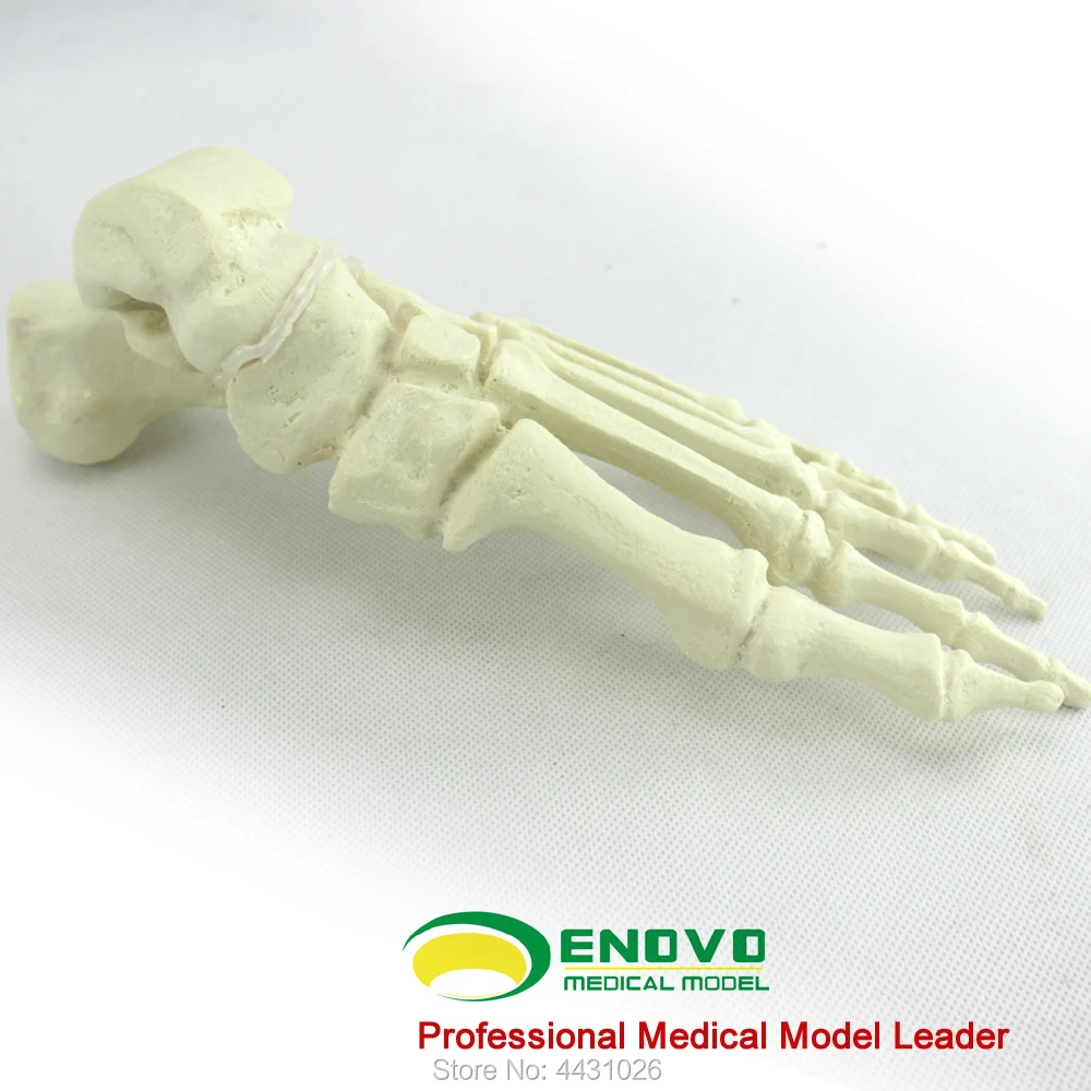 Enovo The Osteopathic Osteopod Of Bone And Bone Of Orthopaedic Bone Was Implanted Into A Simulation Model