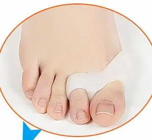 1 пара = 2 шт. корректор вальгусной деформации большого пальца ноги|thumb brace|toe support