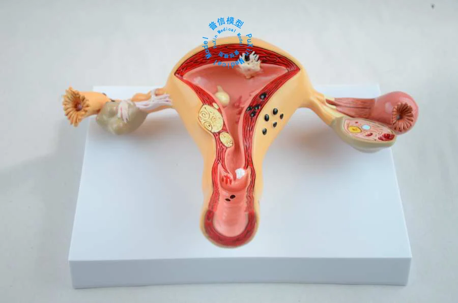

Free shipping&The pathological model of the uterus,Uterine anatomy,genital organ dissect model,Teaching for medical