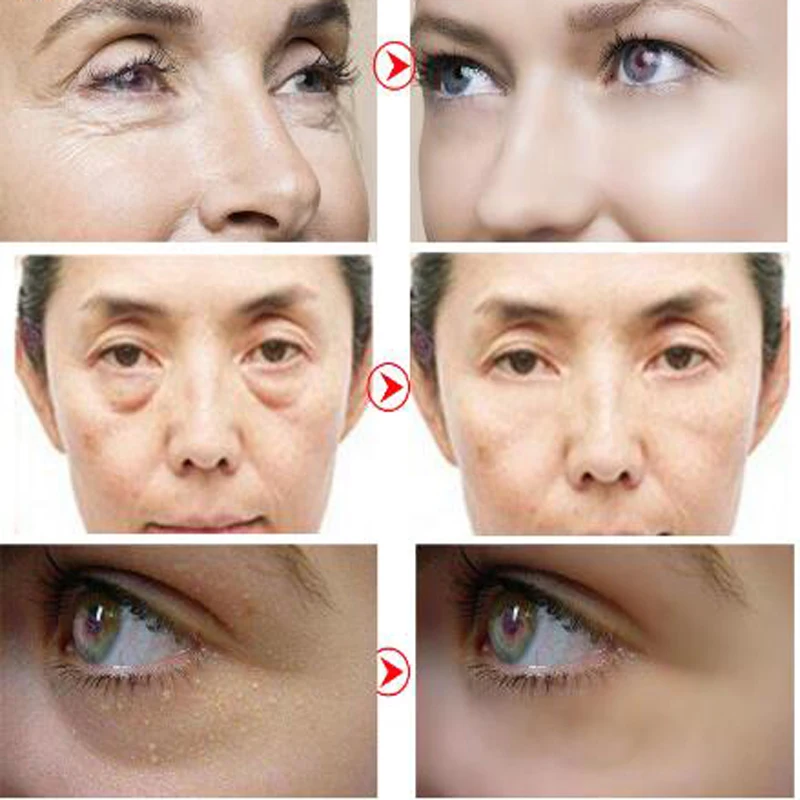 

Lilia Caviar Crystal Eye Mask Gel Eye 10 Pairs Eye Care Sleep Masks Remover Dark Dircles Caviare Anti Age Bag Eye Wrinkle Patch