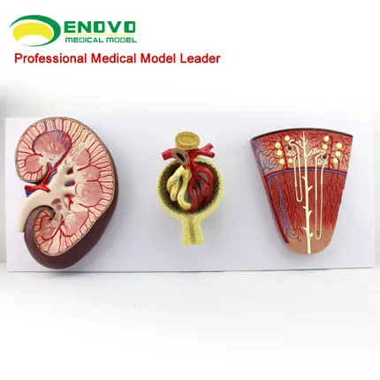 

KeyWord: anatomical structure of human kidney; kidney model; renal;