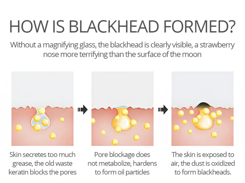 Яркие Гламурные белый маска blackhead Remover Нос Маска для очищения пор пилинг акне Уход глубокое очищение уход за кожей TSLM1