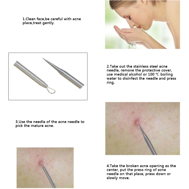 4 шт./компл. лечение угрей и набор штифтов для лечения прыщей инструмент