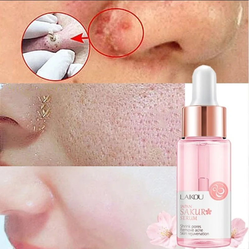 15 мл Сакура Гиалуроновая кислота для удаления пор акне жидкая увлажняющая