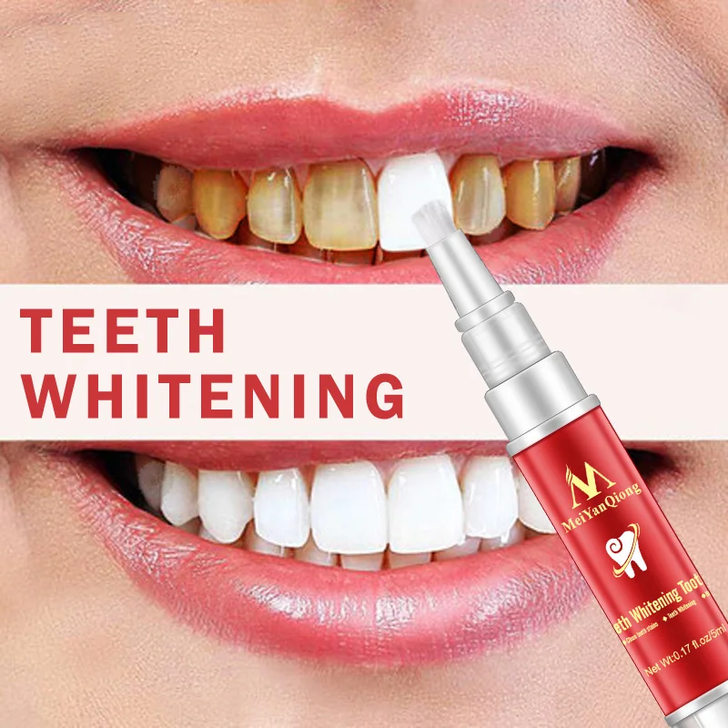 MeiYanQiong 1Pcs 5ML Tooth Cleaning Pen Brush Teeth Whitening Products Dental Gel TSLM1 | Красота и здоровье