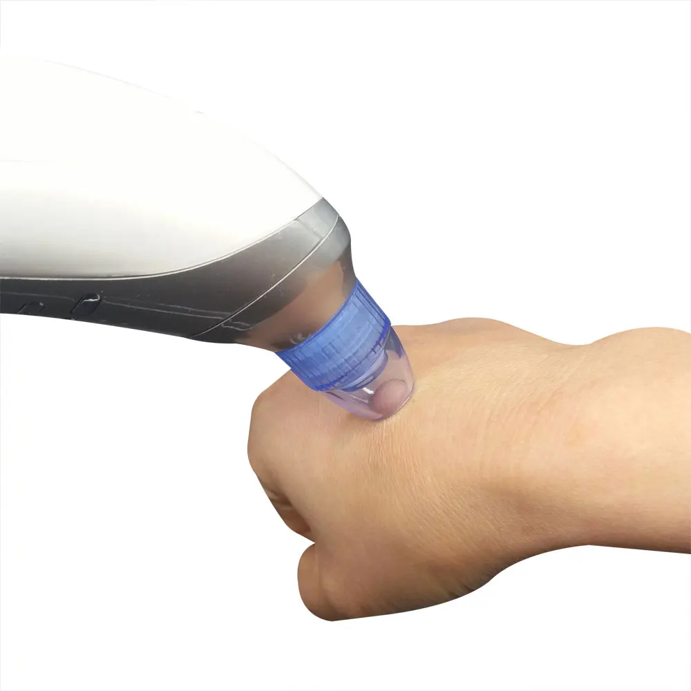 вакуумный очиститель пор уход за лицом для чистки лица|remove blackhead|remover cleanercleaner vacuum |