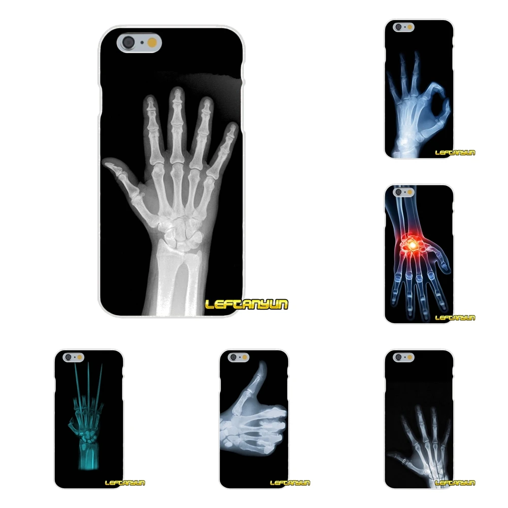 Росомаха X ray ручные кости для Xiao mi 6 A1 Max x 2 5X 6X Red Note 5 5A 4X 4A A4 4 3 Plus Pro мобильный чехол