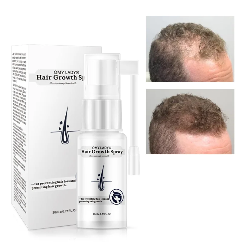 

100% Original Authentic Hair Growth Essential Oils Essence Anti Hair Loss Liquid Beauty Dense Hair Growth