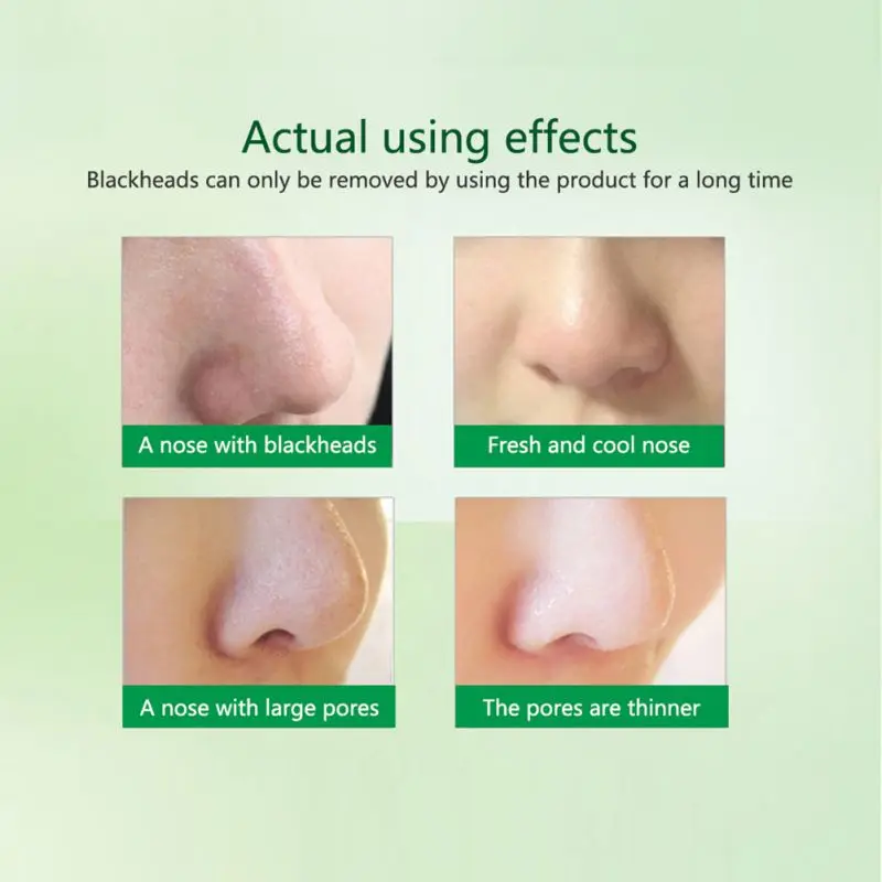 Пылесос Blackhead всасывание удаление для постугревых рубцов пилинг пор уход за
