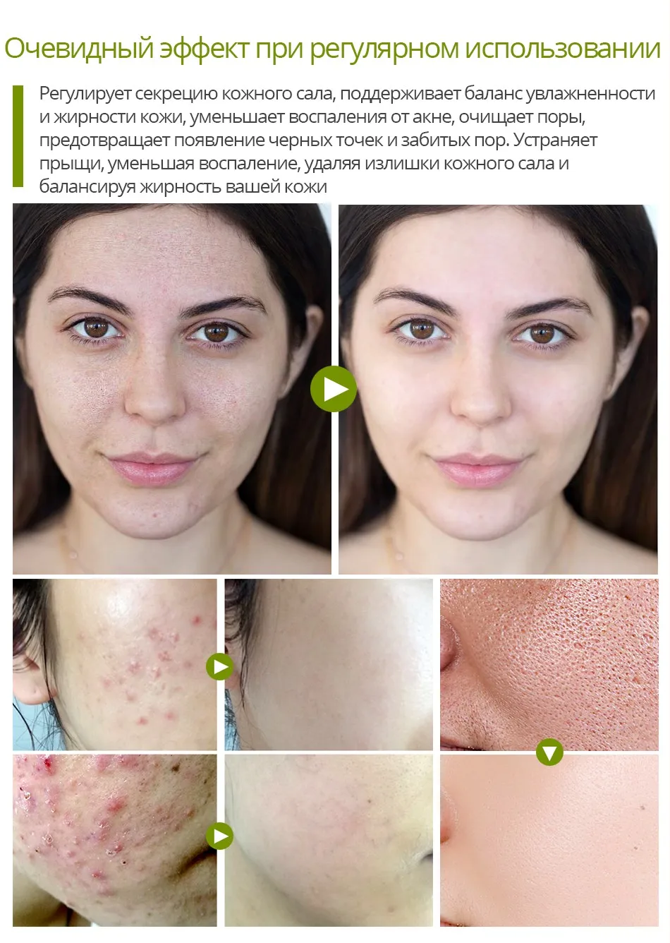 Яркий гламур чайное дерево анти-акне крем для лица акне крем от морщин усадка поры лица устраняет Acnes крем контроль жира ремонт пятно