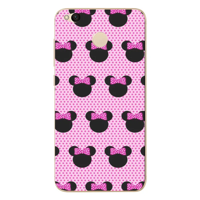 Cartoon Phone Case For Xiaomi Redmi 4X Note 4 4A 3 Cute Mi A1 Pro Soft TPU Sexy Girls Cases D813 |