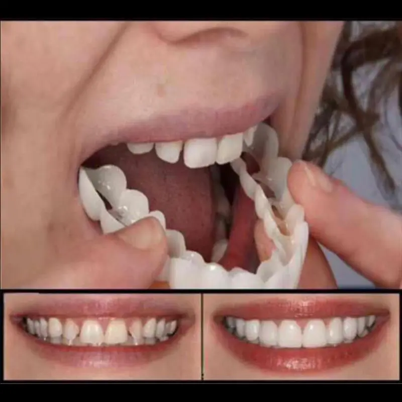 Upper False Fake Tooth Cover Snap On Immediate Smile Cosmetic Denture Care Beauty Tool |