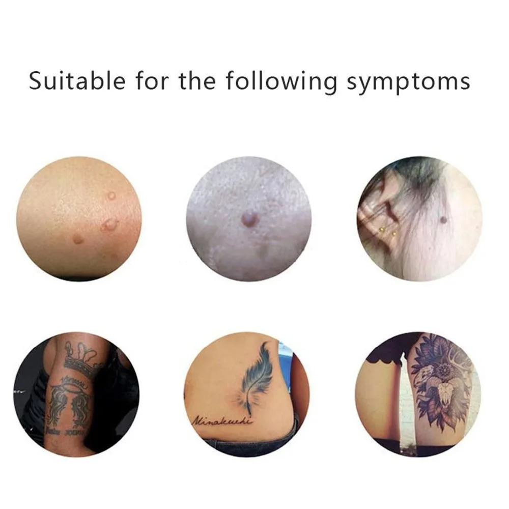 Светодиодная 6 уровневая ручка для удаления моль средство темных пятен