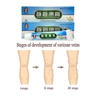 Мазь для лечения варикозного расширения вен, флебит, паук, боль в венах, средство для ангиита, травяной крем для удаления лекарственных средств, 10 шт.