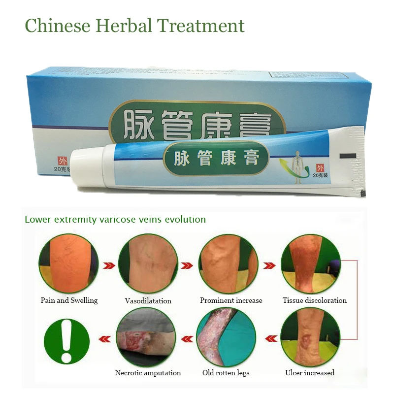

10pcs Chinese Natural Herbal Medicine for Treating Varicose Vascular Inflammation Massage Cream Cure Varicose Vein Ointment