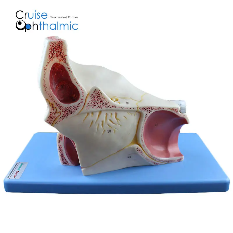 Премиум орбита и глазных мышц 5X модель глазного яблока | Для обучения