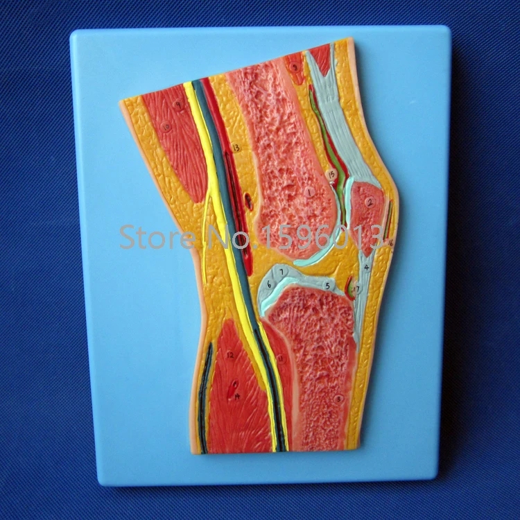 Knee Joint Section Model, Anatomical Knee Joint Model