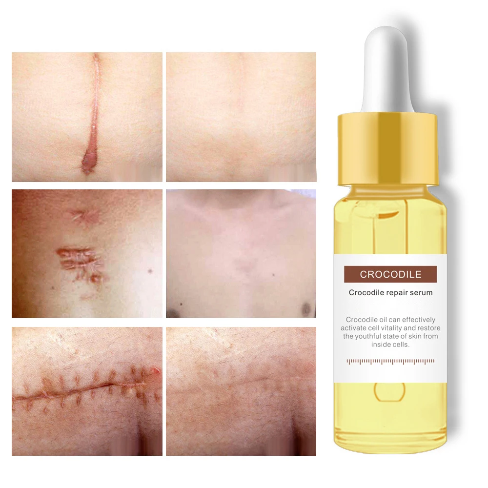 

Сыворотка с крокодиловым маслом, 15 мл, для ухода за кожей