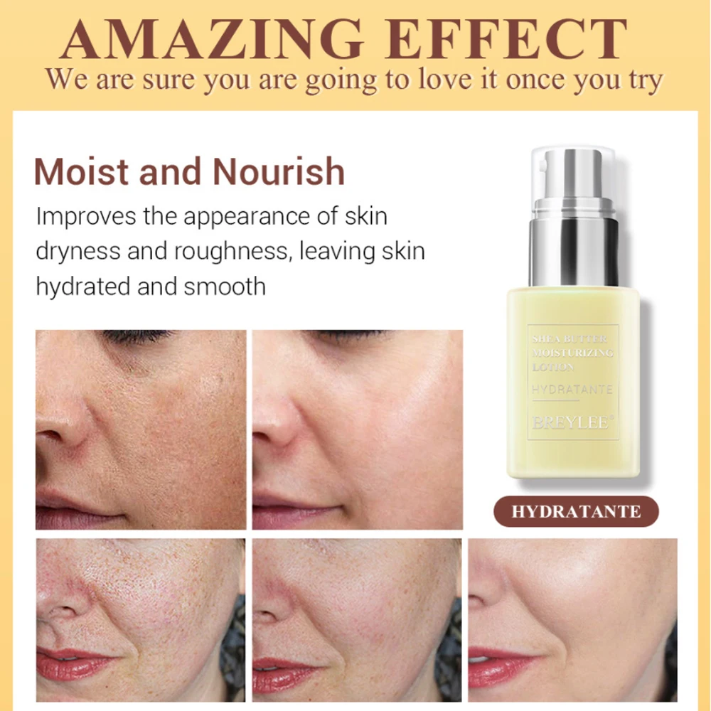 Face Cream Skin Care Anti Acne Treatment Facial Hydratante Shea Butter Moisturizing Lotion Repair Emulsion Day Night | Красота и